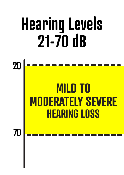 21-70dB is moderate hearing.